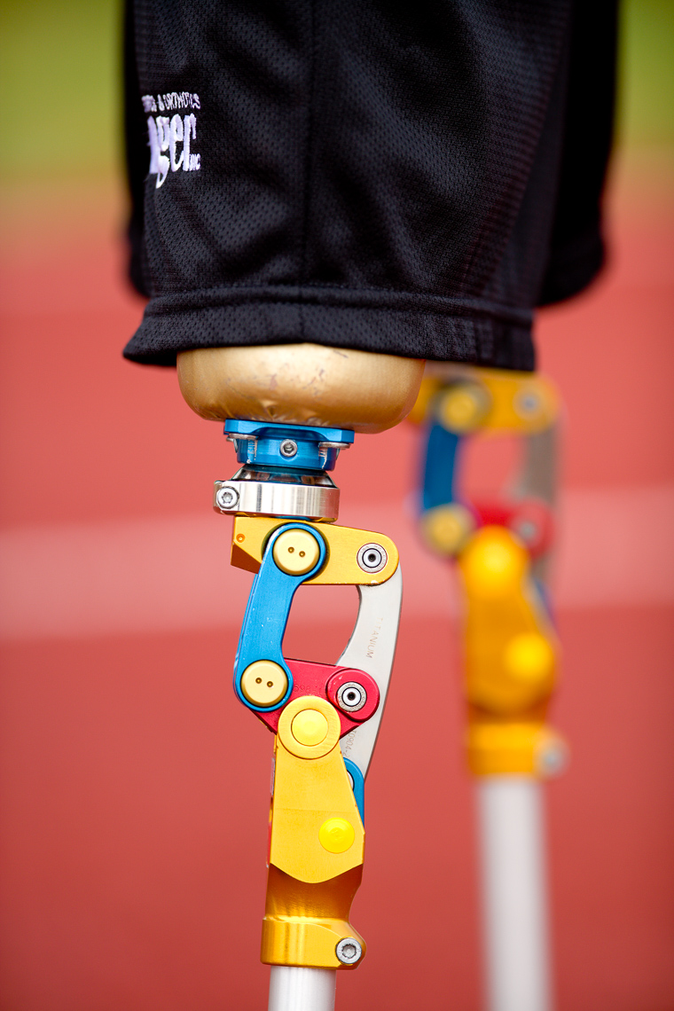 Sports Photo of Amputated Legs on Track